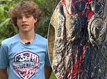 Florida teenager, 13, who survived horror alligator attack reveals how he punched the reptile